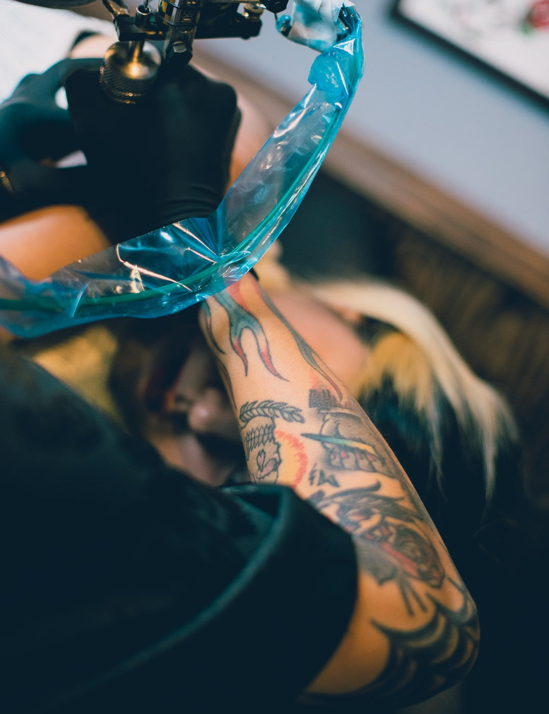 Considering Laser Tattoo Removal? Here's What You Need to Know
